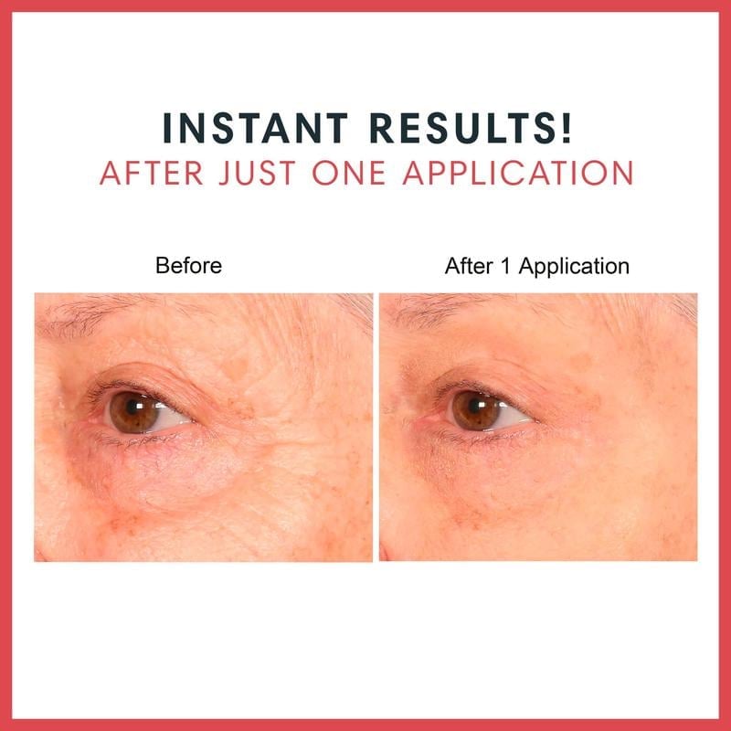 🔥🔥Consult Beaute REAL-EYEZ-ATION Tinted Firming Eye Gel